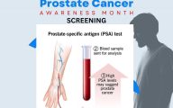 prostate-specific antigen, or PSA